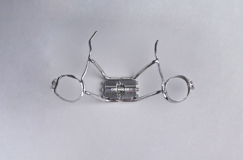 Disjoncteur soudé sur bagues par Orthogem laboratoire spécialisé en prothèse ODF et orthodontie en France qualité réglage rapidité