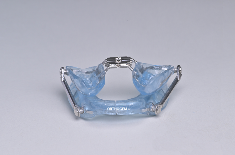 Bielle de Herbst par Orthogem laboratoire spécialisé en ODF et orthodontie en France qualité réglage rapidité